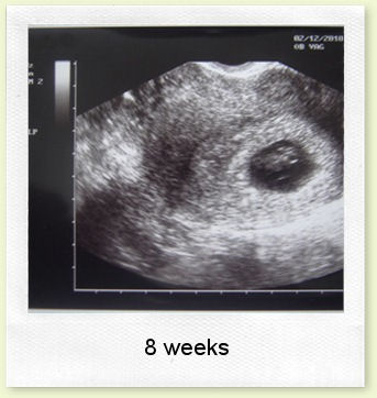 9 weeks pregnant. tagged 9 weeks pregnant,