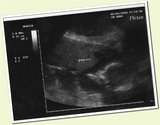 ultrasoundprofile